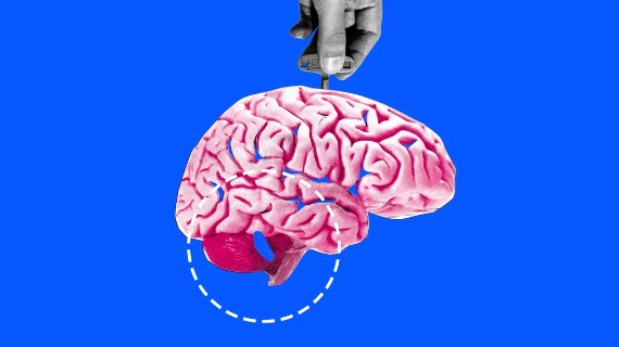 An illustration shows a hand inserting a key into a brain. A blue dot at the back of the neck is circled to draw attention to it.